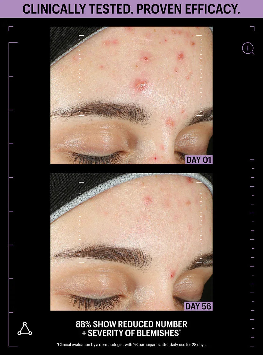 ALLIES OF SKIN | Azelaic & Kojic Advanced Clarifying Serum - 30ml - InternationalCosmetic