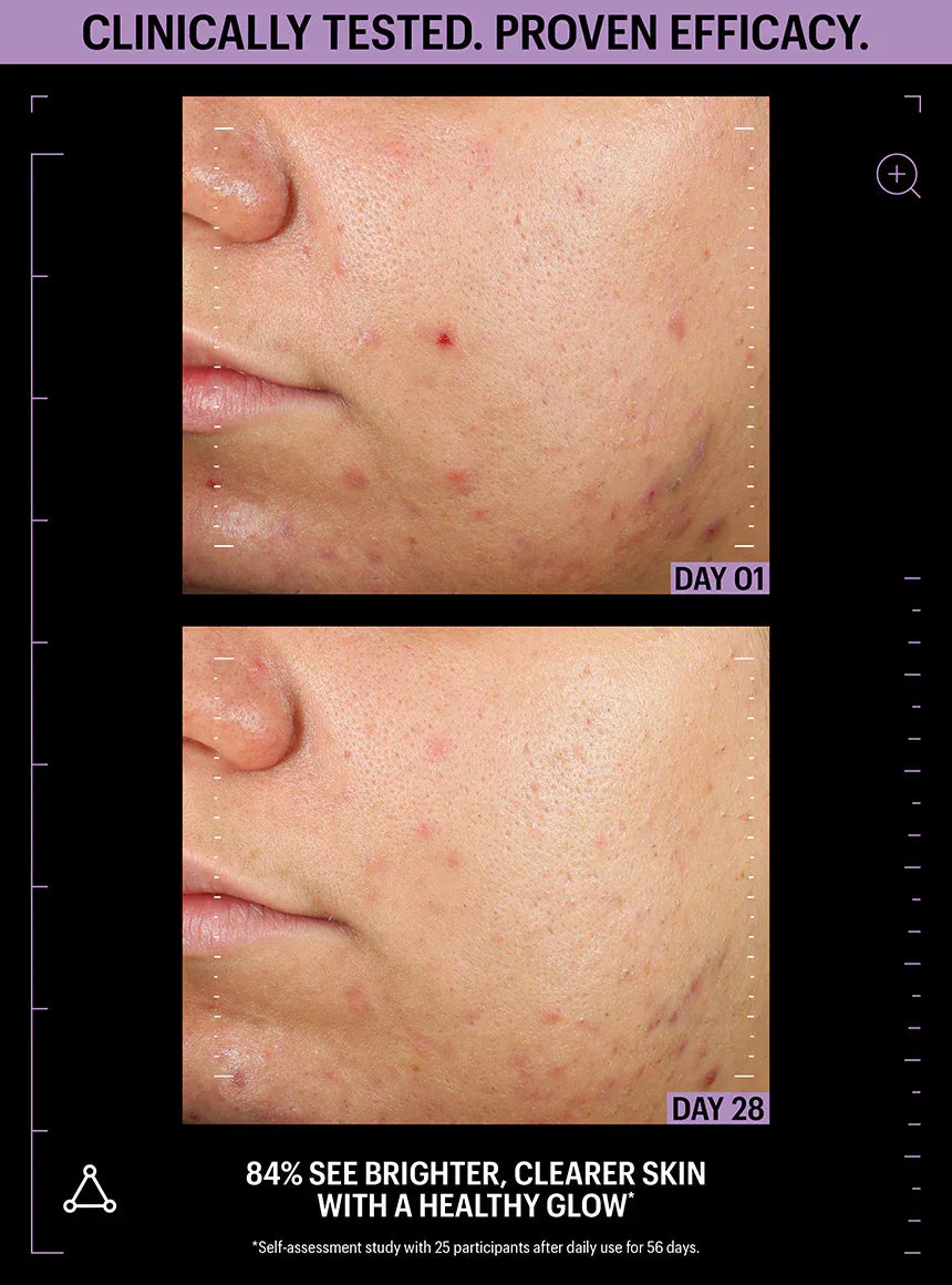 ALLIES OF SKIN | Azelaic & Kojic Advanced Clarifying Serum - 30ml - InternationalCosmetic
