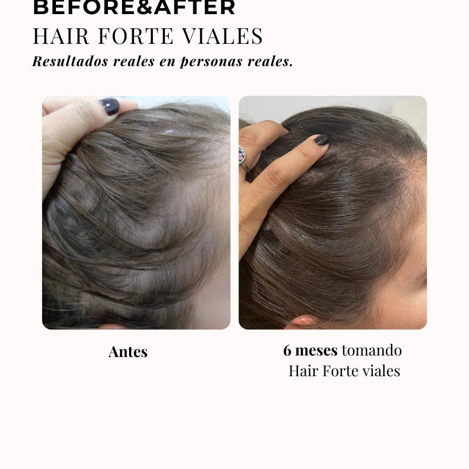 CHIC & LOVE | 360º Hair Formula Forte Elixir Cabello - 20 viales