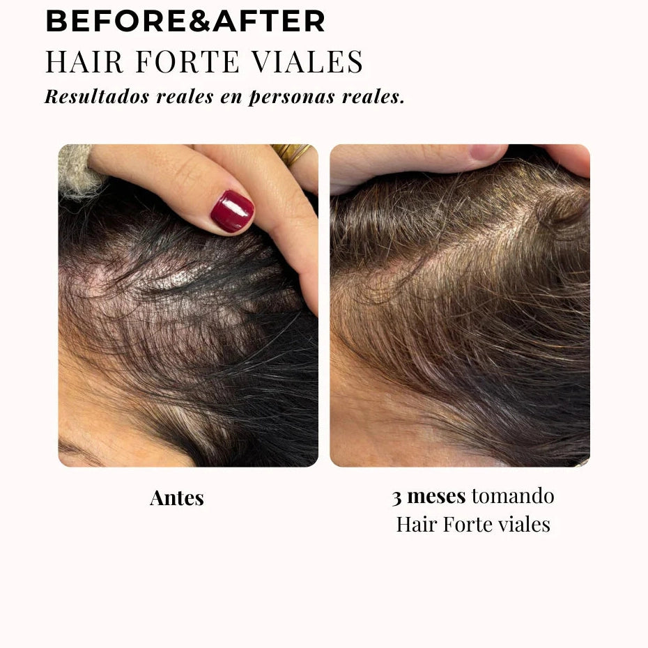CHIC & LOVE | 360º Hair Formula Forte Elixir Cabello - 20 viales