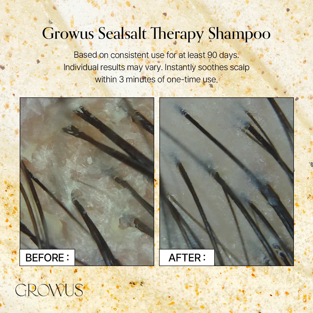 GROWUS | Sea Salt Therapy Shampoo - 500ml - InternationalCosmetic
