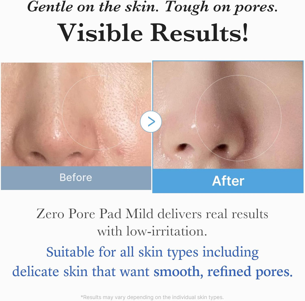 MEDICUBE | Zero Pore Pad Mild - 70ud
