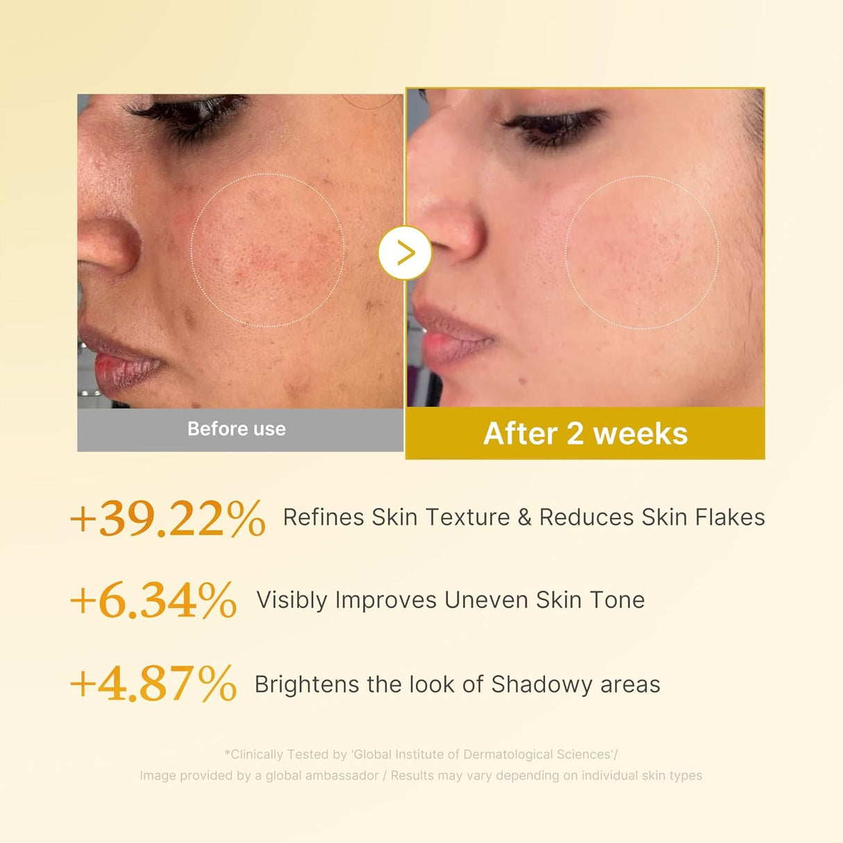 MEDICUBE | Kojic Acid Turmeric Resurfacing Toner - 250ml