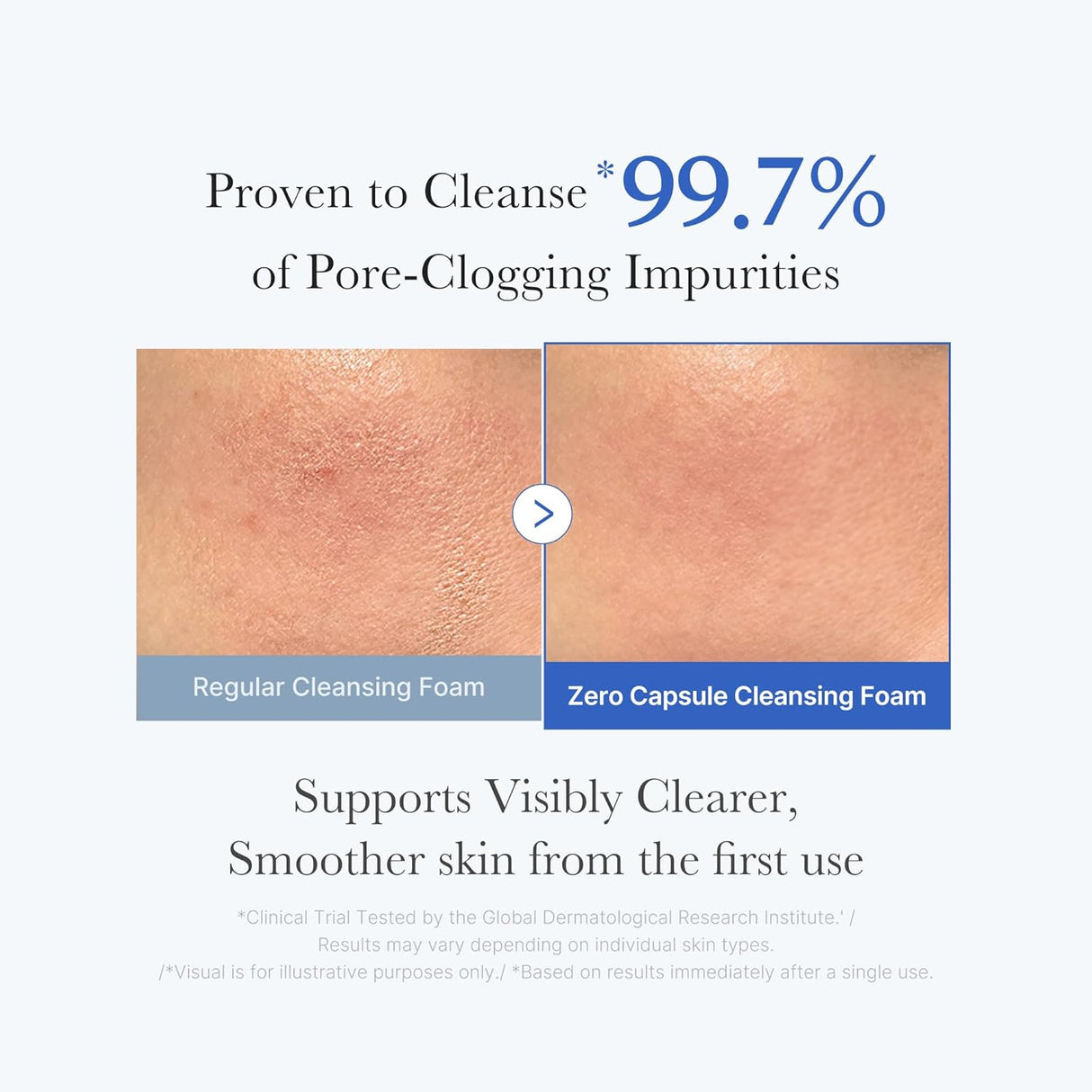 MEDICUBE | Zero Pore SA Clear Capsule Cleansing Foam - 120 gr