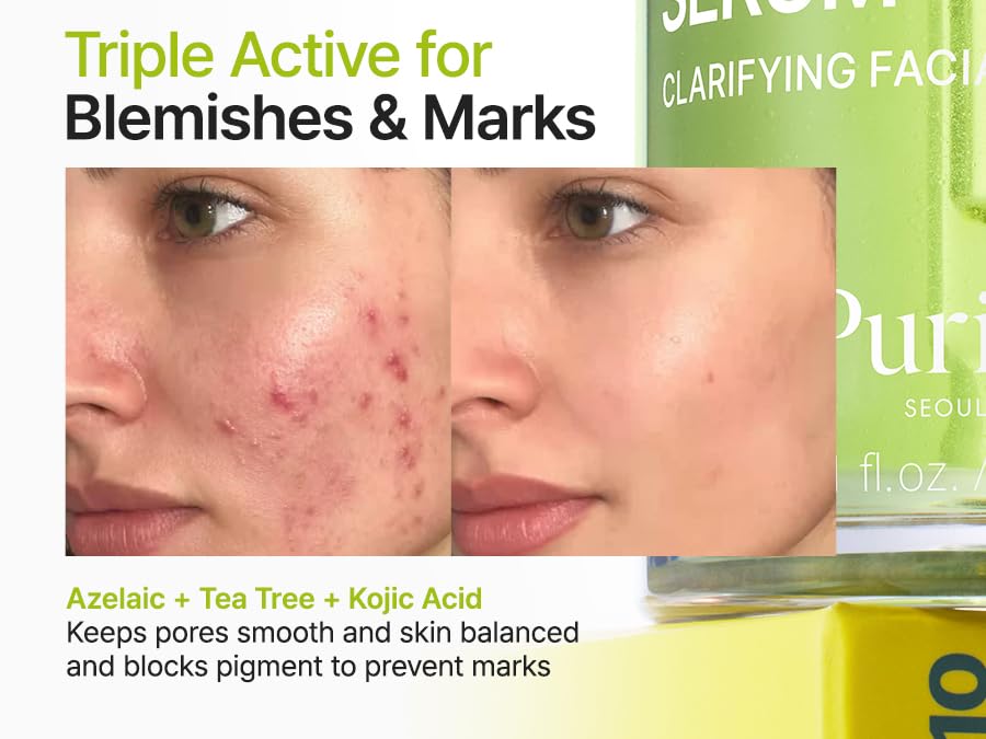 PURITO | Azelaic Acid 10 Kojic Tea Tree Serum - 30ml