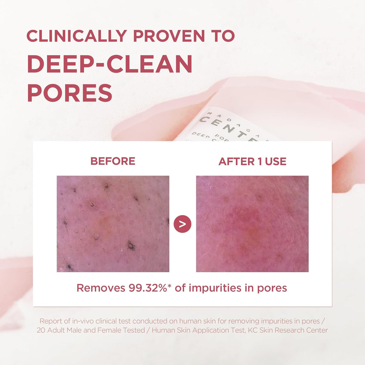 SKIN 1004 | Madagascar Centella Poremizing Deep Cleansing Foam - 125ml