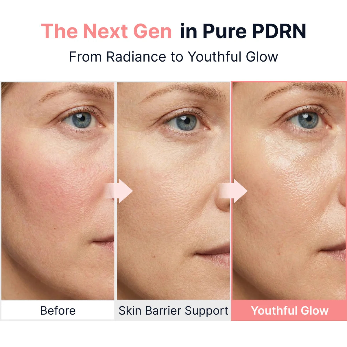 SUNGBOON EDITOR | PDRN Pink Vitamin Glow Boosting Ampoule - 40ml