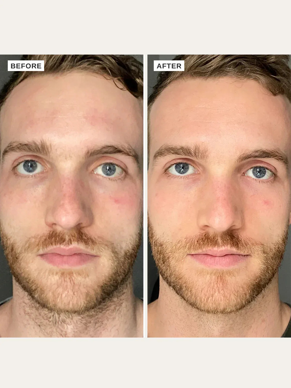 ALPHA-H | Vitamin B Serum - InternationalCosmetic