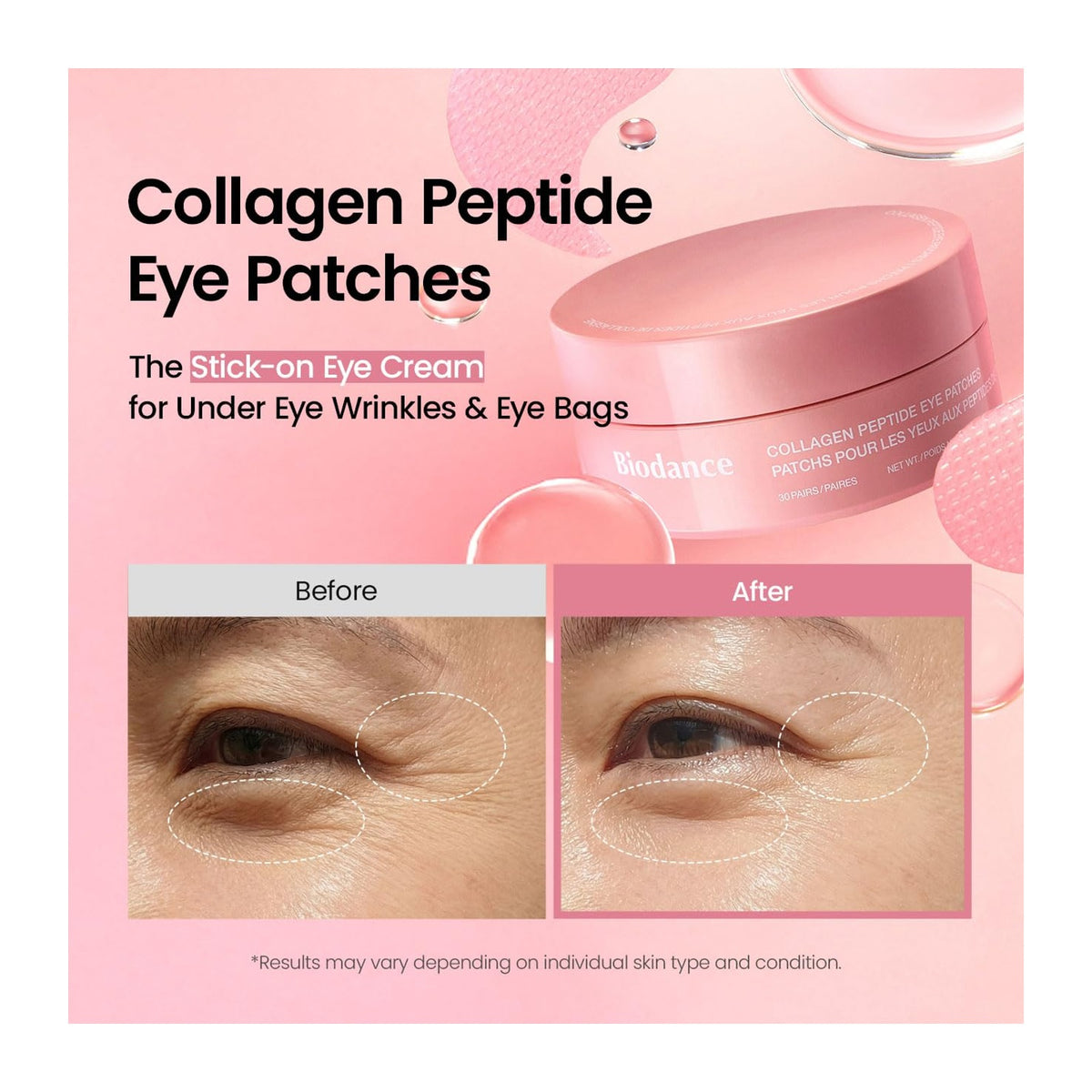 BIODANCE | Collagen Peptide Eye Patches - 30 pares
