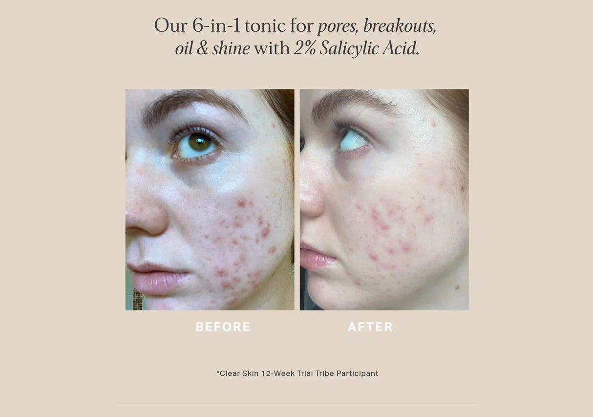ALPHA-H | Clear Skin Tonic - InternationalCosmetic
