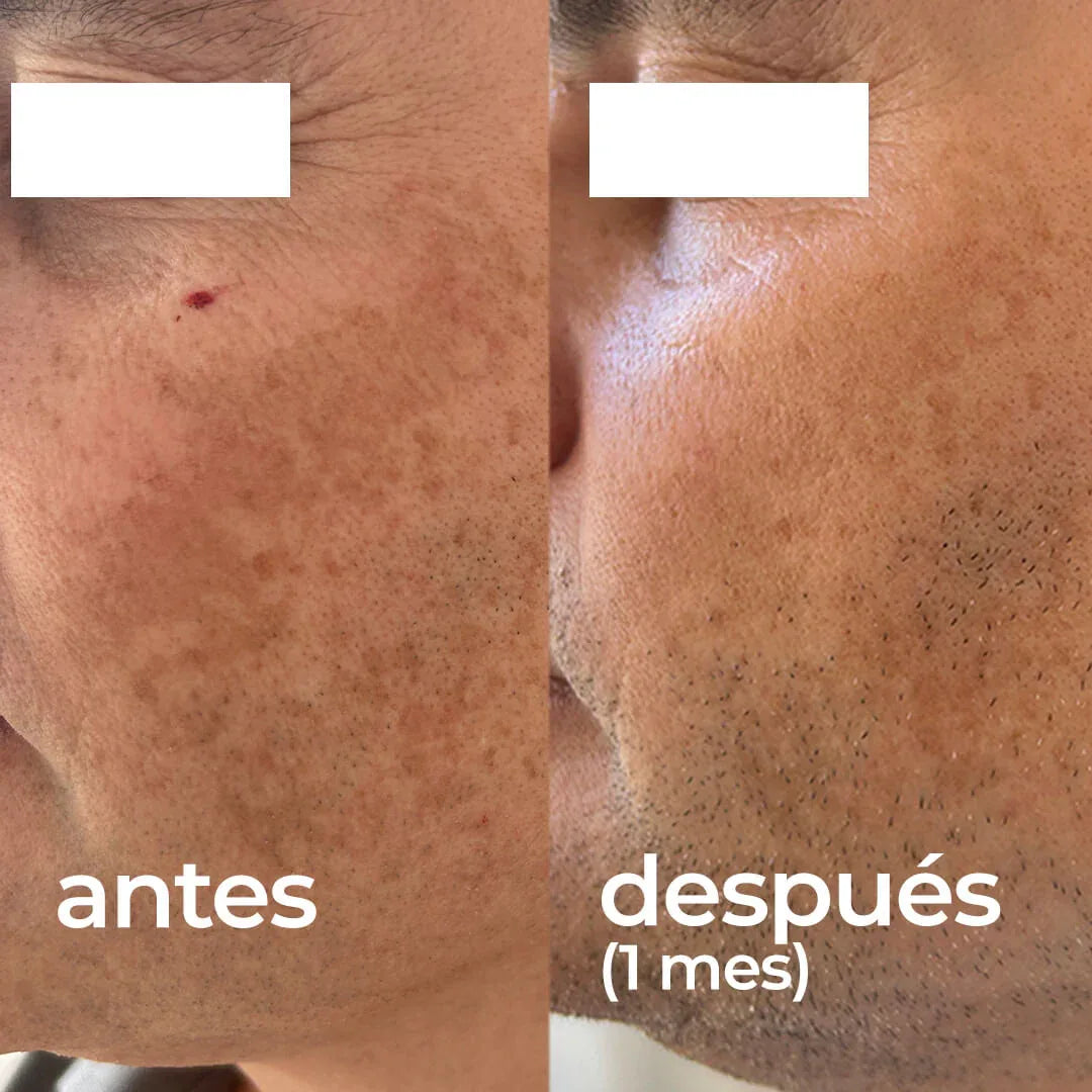 SEGLE | Clear Skin Pack Despigmentante - 60ml - InternationalCosmetic
