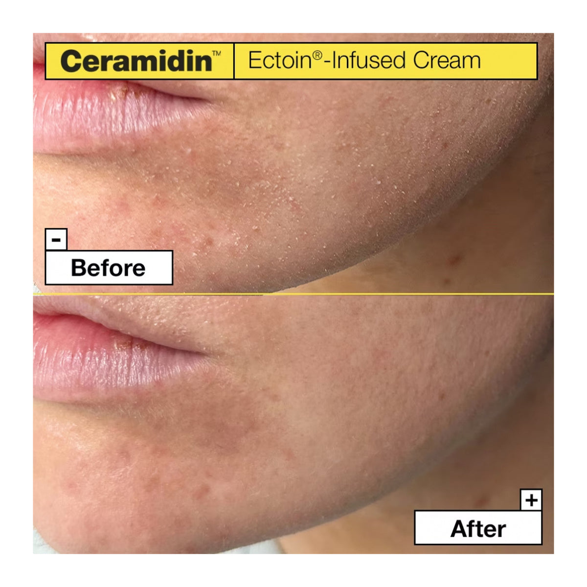 DR. JART+ | Ceramidin Ectoin-Infused Cream - 50ml