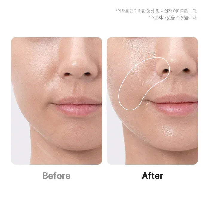 MEDICUBE | AGE - R Booster Pro - APEC Irworobongdo Edition