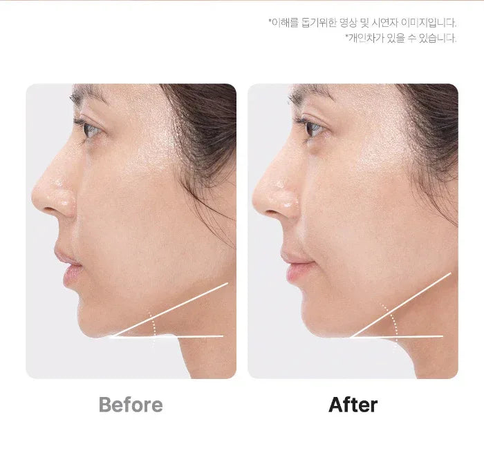 MEDICUBE | AGE - R Booster Pro - APEC Irworobongdo Edition