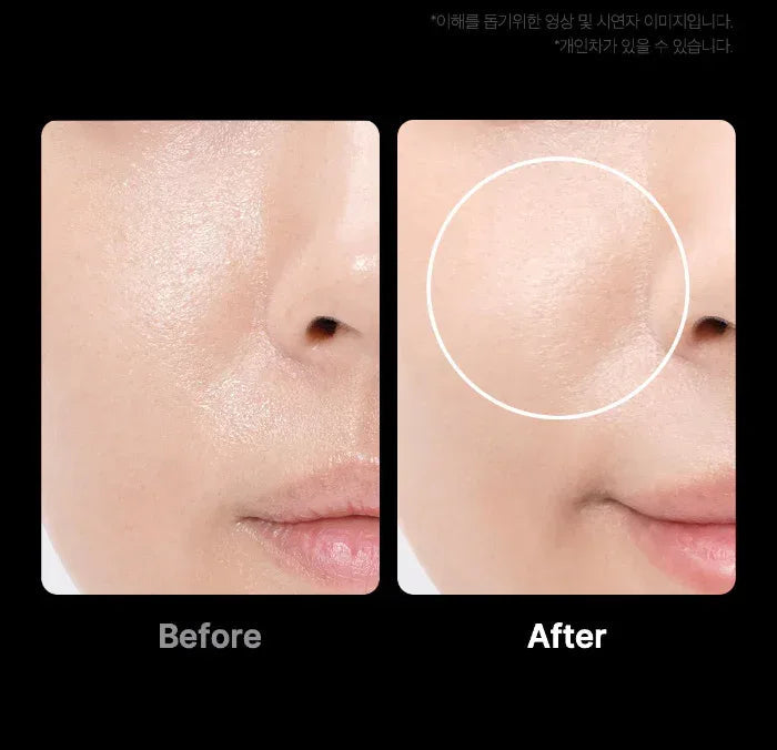 MEDICUBE | AGE - R Booster Pro - APEC Irworobongdo Edition