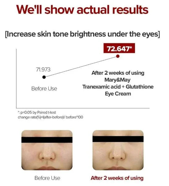 MARY & MAY | Glutathione Eye Cream Special Set - 54 gr - InternationalCosmetic