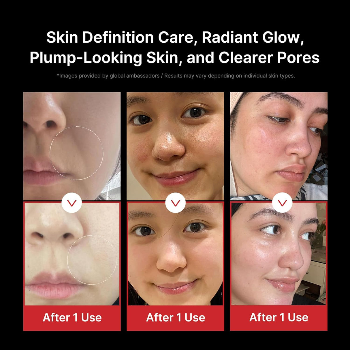 MEDICUBE | AGE - R Booster Pro - APEC Irworobongdo Edition