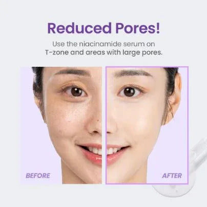 TIRTIR | Niacinamide 20% Serum - 30 ml - InternationalCosmetic