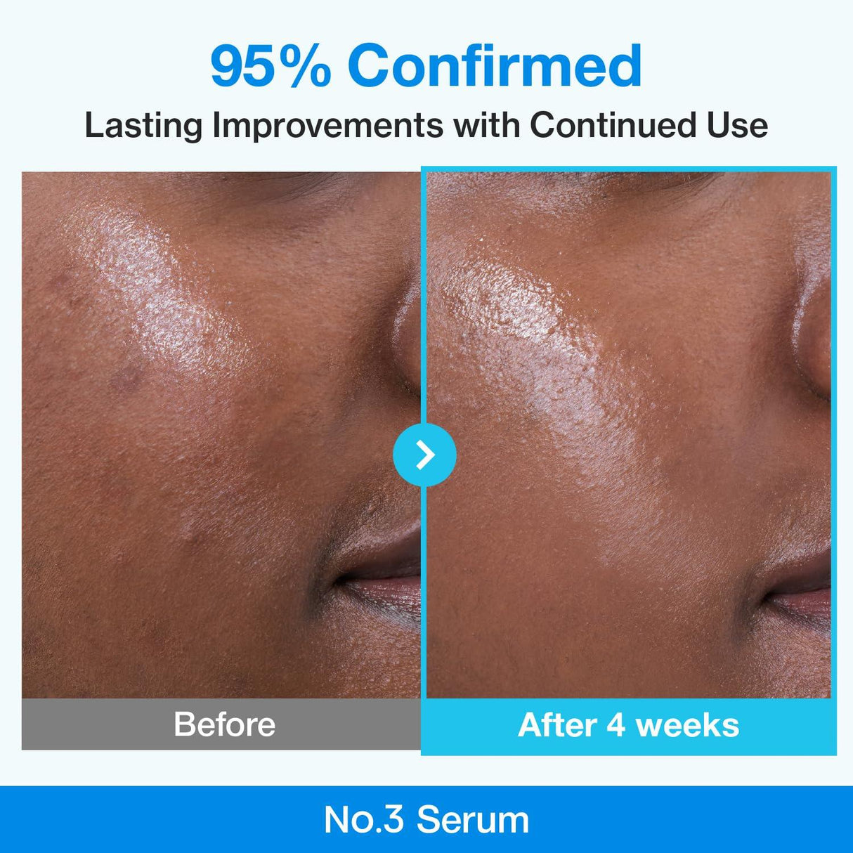 NUMBUZIN | No.3 Blue Bio-Retinol Pore Refining Serum - 30ml - InternationalCosmetic