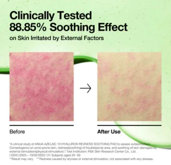 ANUA | Azelaic 10 Hyaluron Redness Soothing Pad - 90ml - InternationalCosmetic