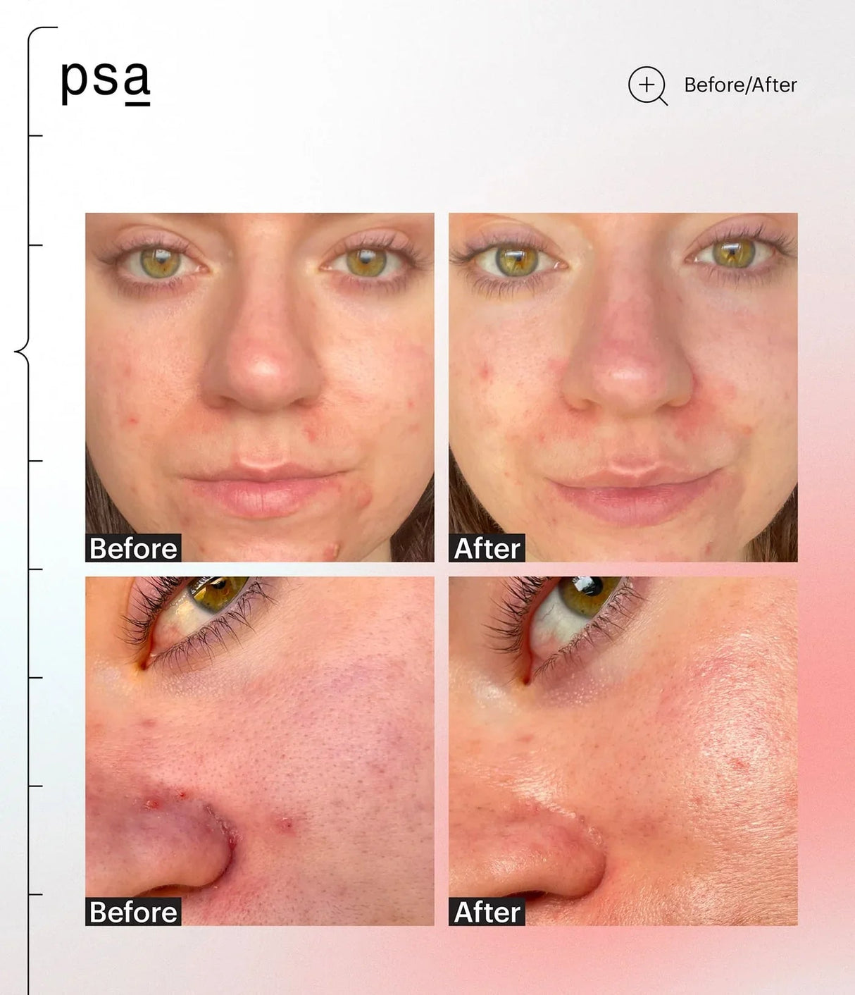 PSA | Goals Multi Acids & Probiotics Perfecting Night Serum - InternationalCosmetic