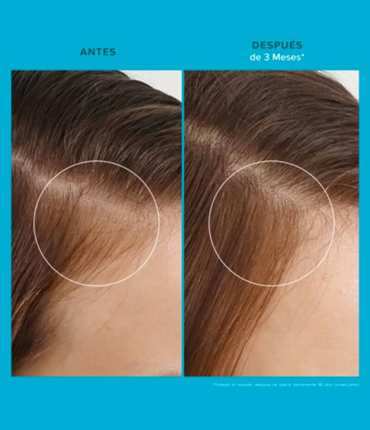 LIVING PROOF | Scalp Care Revitalizing Treatment - 73ml - InternationalCosmetic