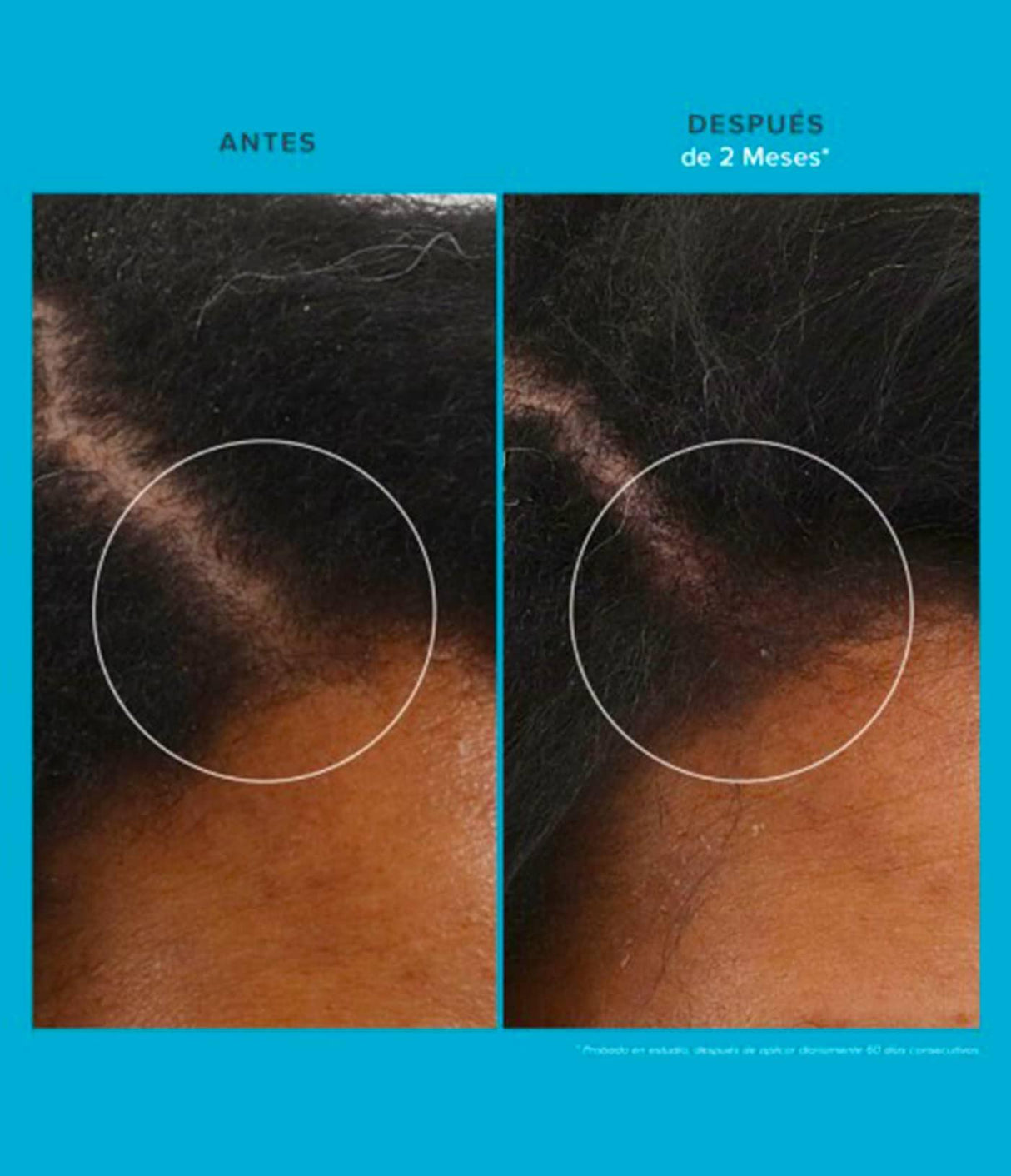 LIVING PROOF | Scalp Care Revitalizing Treatment - 73ml - InternationalCosmetic