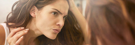 Hiperplasia sebácea - InternationalCosmetic
