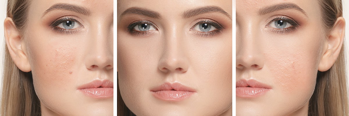 ¿Qué es la Niacinamida? - InternationalCosmetic