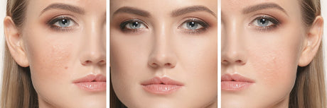 ¿Qué es la Niacinamida? - InternationalCosmetic