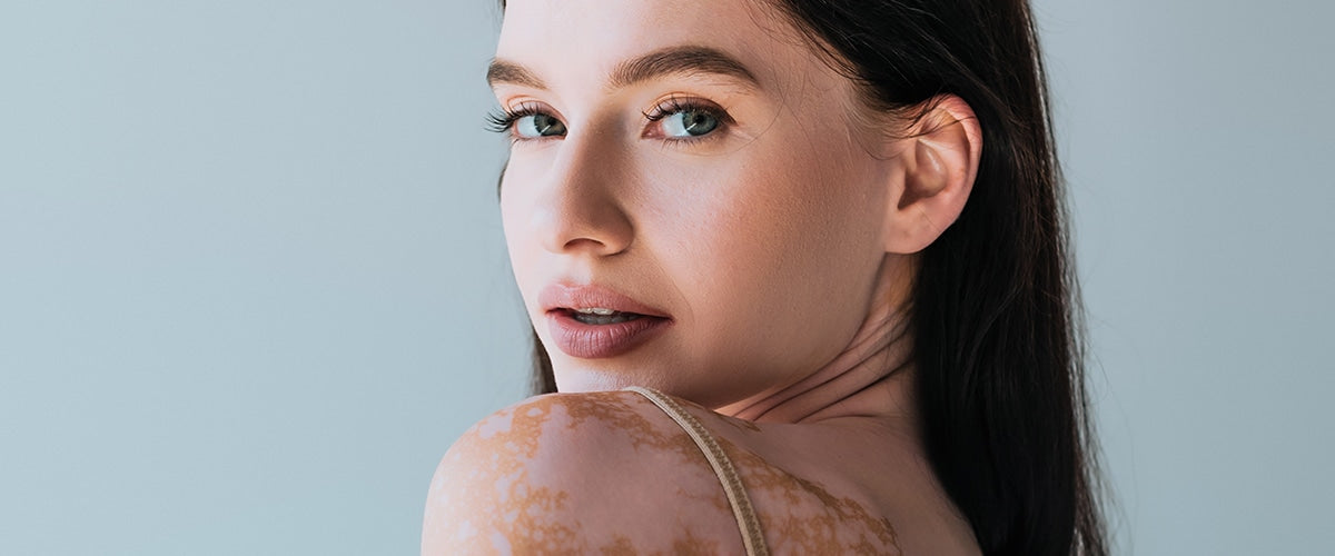 ¿Qué significa tener el tono desigual de la piel? - InternationalCosmetic