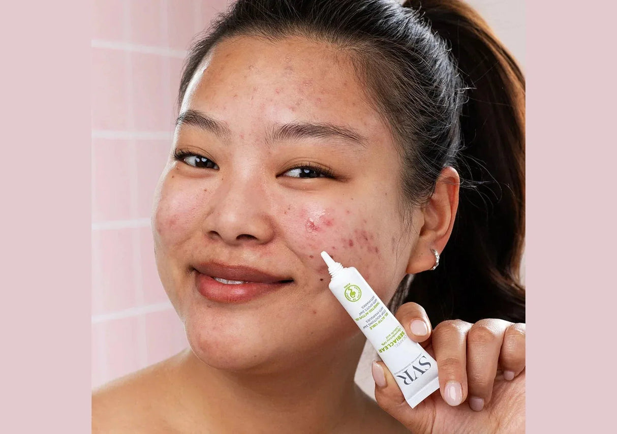 SVR | Sebiclear Cicapeel - InternationalCosmetic