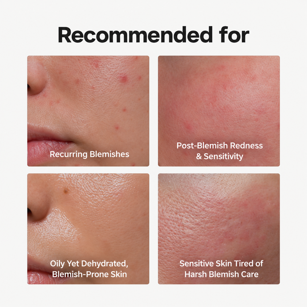 DR. ALTHEA | 345 Relief Spot Powder - 15ml