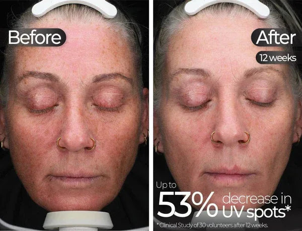 STYLPRO | Wavelength Pro 5-in-1 LED Mask - InternationalCosmetic
