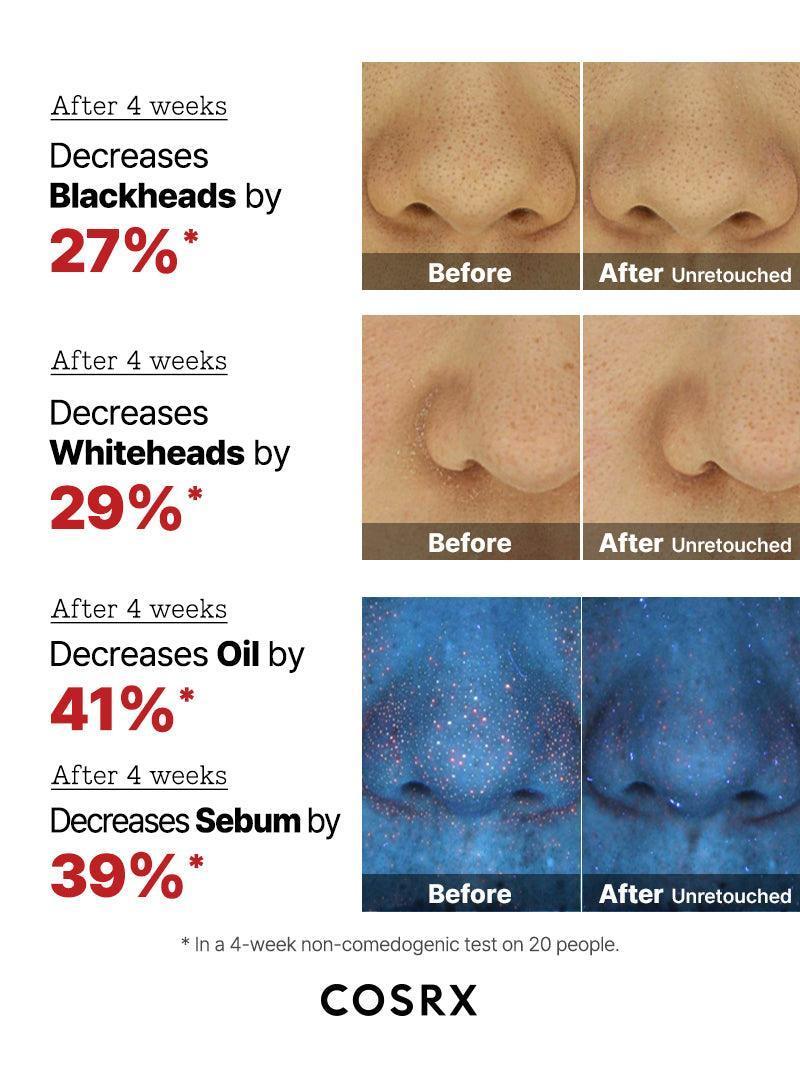 COSRX | The AHA 2 BHA 2 Blemish Treatment - 50gr - InternationalCosmetic
