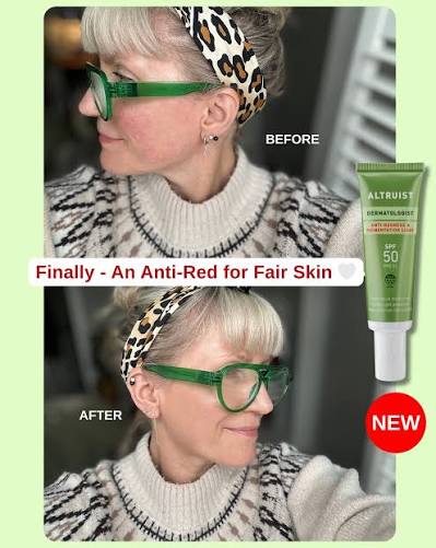 ALTRUIST | Anti-Redness & Pigmentation Light SPF50 - 30ml