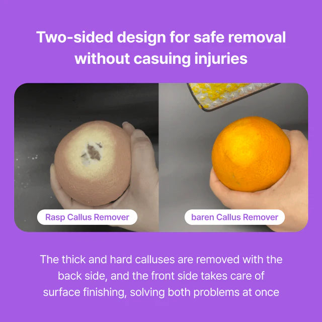 BAREN | Callus Remover Magic Stainless Pro Double Sided Foot File