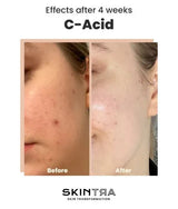 SKINTRA | C-Acid - 30ml - InternationalCosmetic