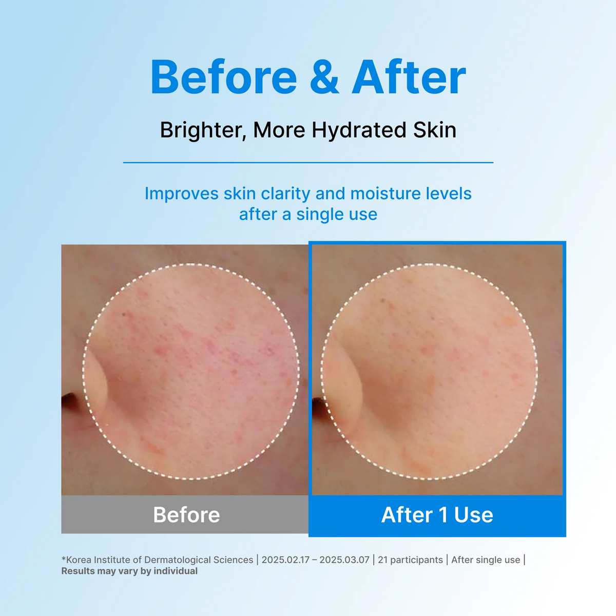 CENTELLIAN 24 | Hyal Waterfull Glow Gel Mask