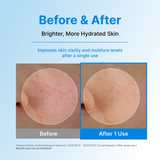 CENTELLIAN 24 | Hyal Waterfull Glow Gel Mask