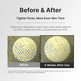CENTELLIAN 24 | Madeca Powder Tea Tree AC - 6g