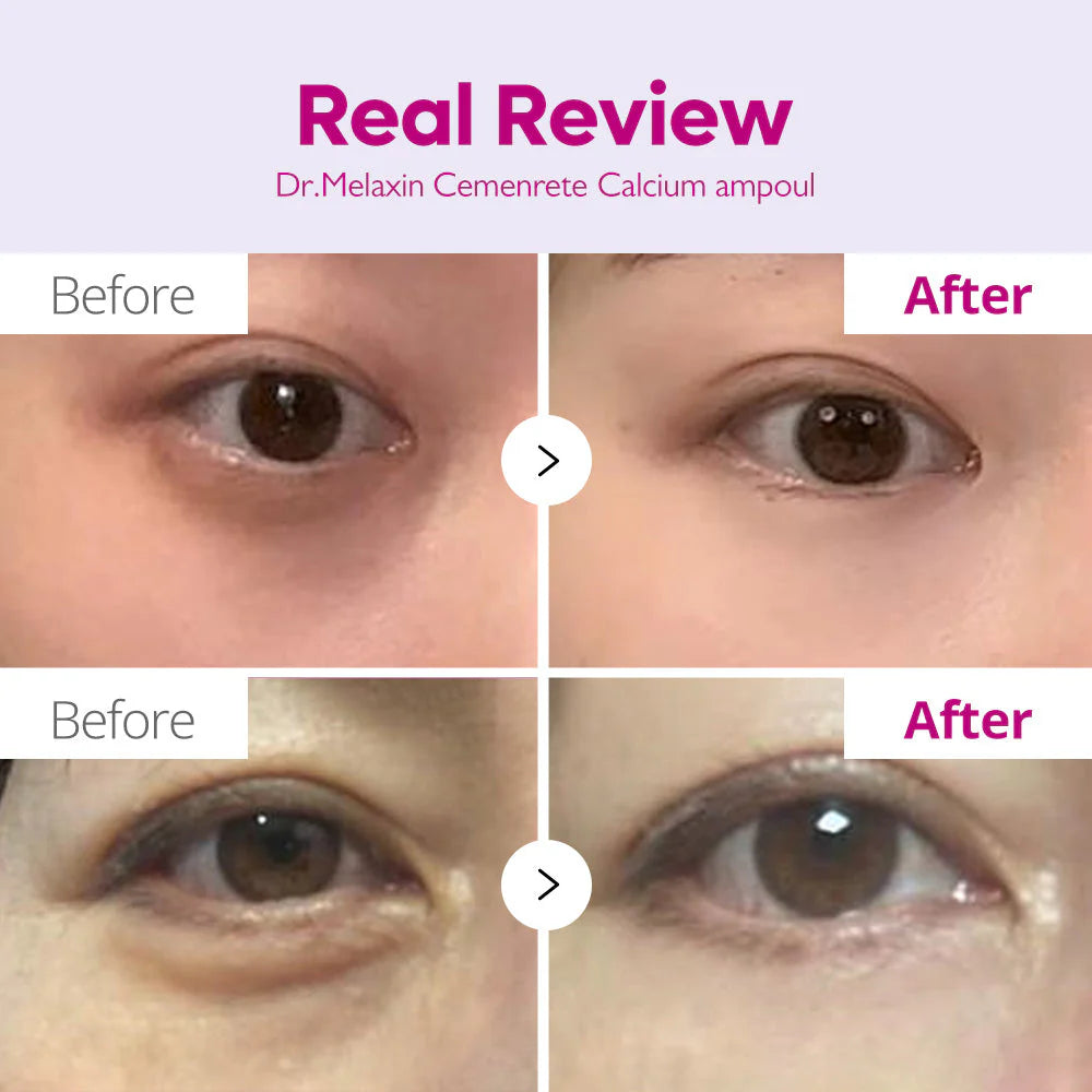 DR. MELAXIN | Cemenrete Calcium Intense Ampoule Plus - 30ml