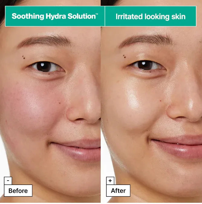DR. JART | Soothing Hydra Solution - 25gr - InternationalCosmetic