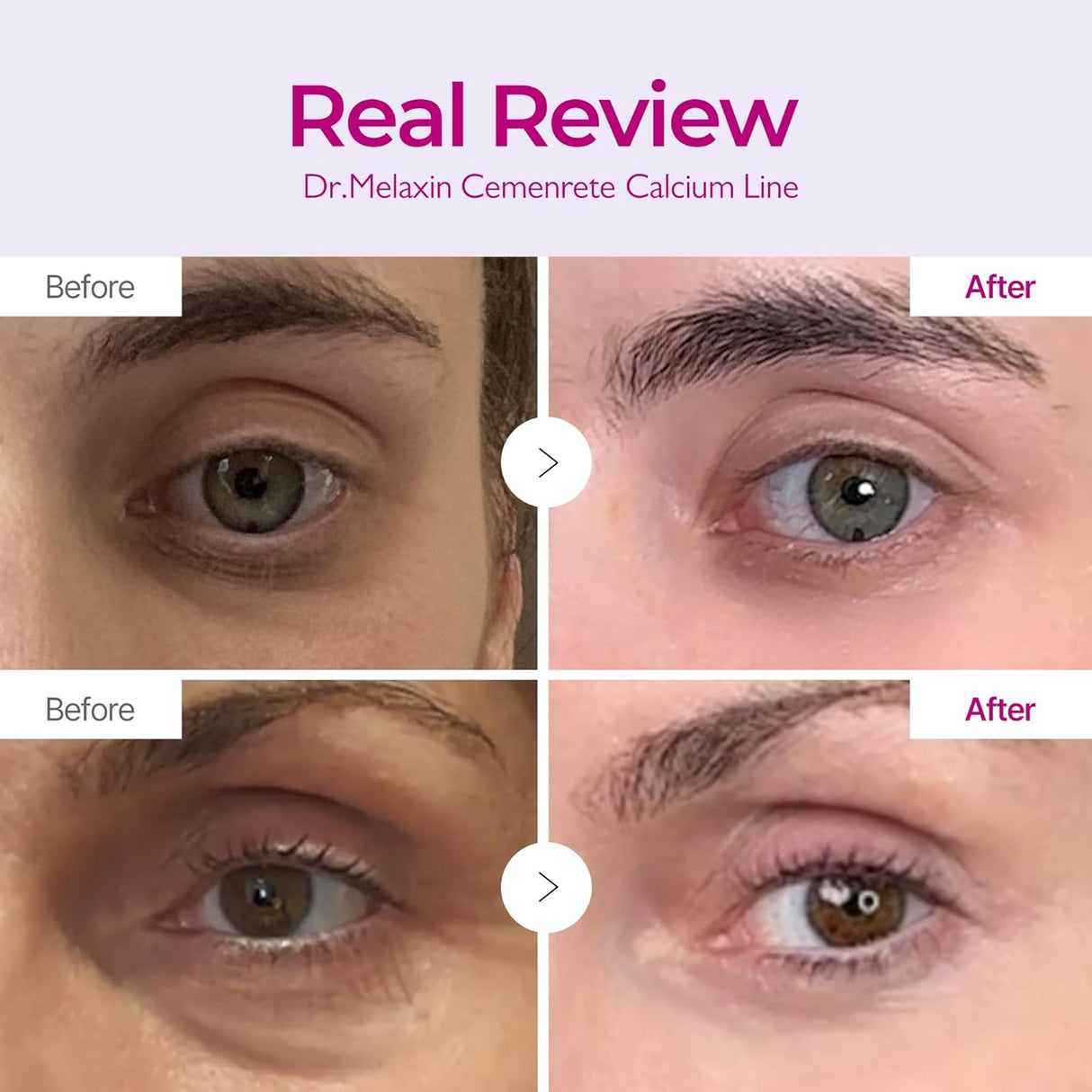 DR. MELAXIN | Cemenrete Calcium Intense Cream - 50ml