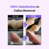 BAREN | Foot Exfolian Softener At-Home Kit