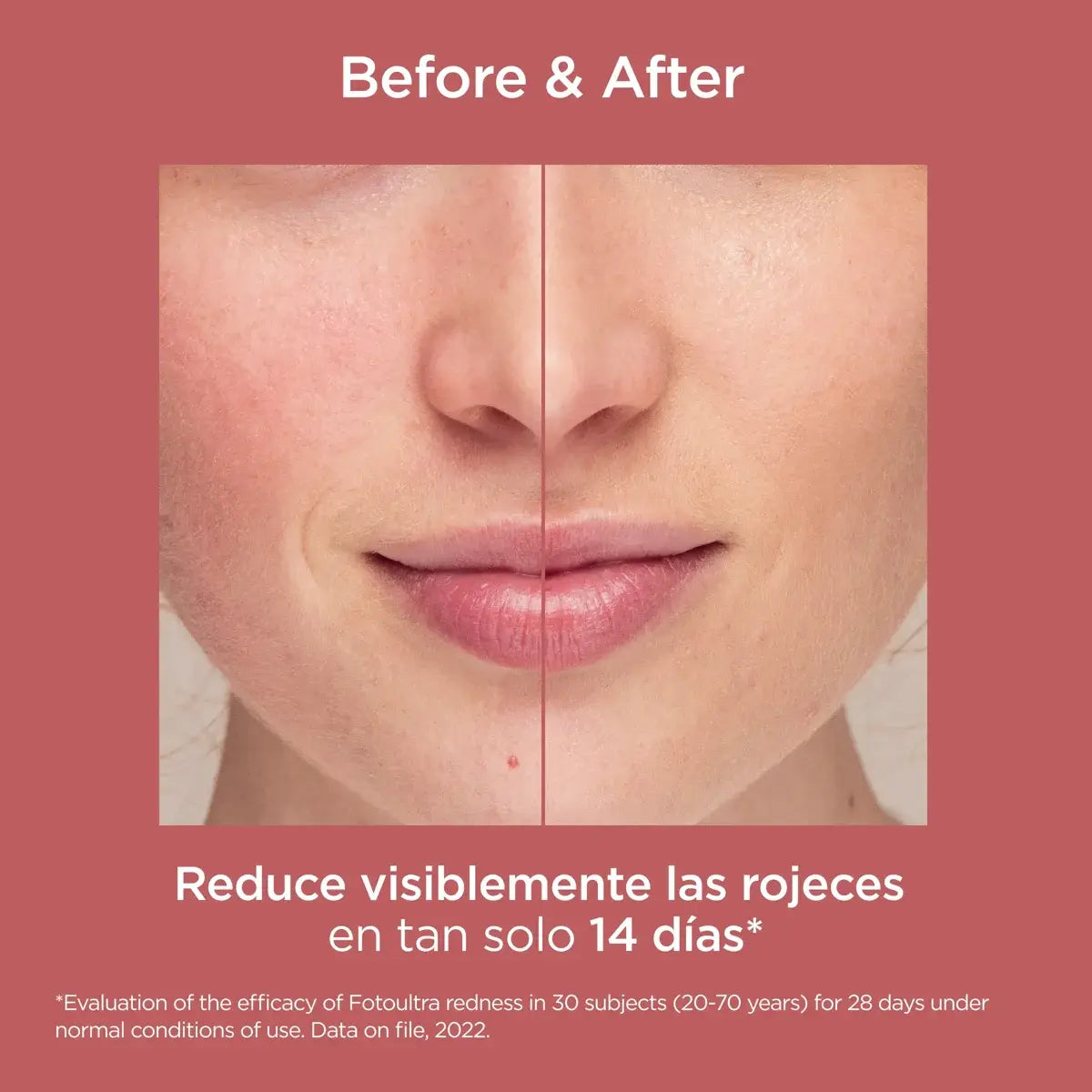 ISDIN | FotoUltra Redness SPF50 - 50ml
