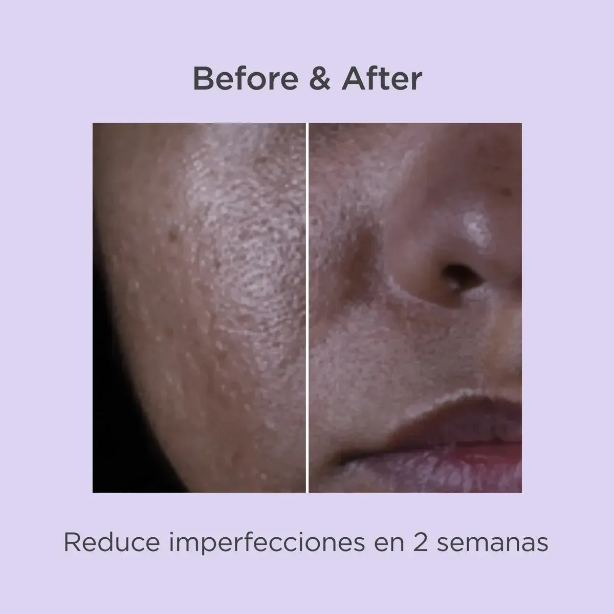 ISDIN | Isdinceutics Salicylic Renewal - 30ml - InternationalCosmetic