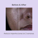 ISDIN | Isdinceutics Salicylic Renewal - 30ml - InternationalCosmetic