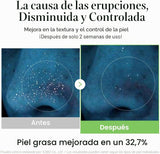 MEDICUBE | Exosome CICA Toner - 210 ml