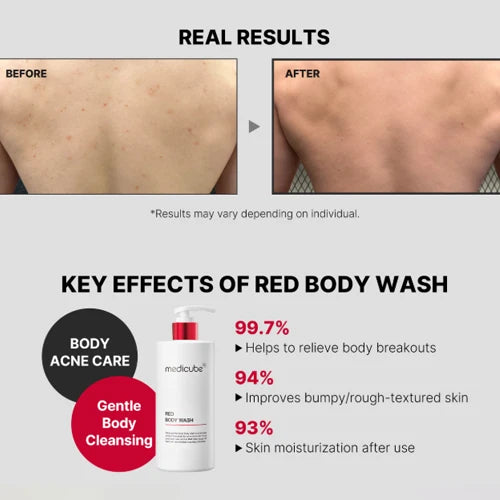 MEDICUBE | Red Acne Body Wash - 400 ml